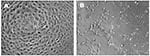 Thumbnail of Microscopic appearance of control (a) and infected (b) Vero E6 cells demonstrating cytopathic effects.