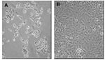 Thumbnail of Interferon (IFN)-β 1a inhibition of SARS-CoV cytopathicity in Vero E-6 cells. Vero E-6 cells were infected with the Tor2 isolate of SARS-CoV and incubated for 72 h in the absence (left panel) or presence (right panel) of 500,000 IU of recombinant human IFN-β 1a. Cell rounding and detachment were prominent in the absence of IFN-β 1a. Minimal cell rounding or death was noted in the intact monolayer at 72 h postinoculation in the presence of IFN-β 1a (note: IFN-β 1a administered 1 h po