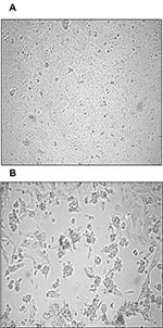 Thumbnail of Cytopathic effect (CPE) of primary severe acute respiratory syndrome–associated coronavirus strain HSR1 isolate. A, uninfected Vero cells form a continuous monolayer of spindle-shaped cells. B, a strong CPE was observed after 24 hours of incubation of Vero cells with the patient sputum sample (primary isolate).