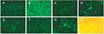 Thumbnail of Detection of the severe acute respiratory syndrome-associated coronavirus (SARS-CoV) in the epithelial cells in throat wash from SARS patients by an indirect immunofluorescence assay. (A,B) Spot slides of SARS-CoV-infected Vero E6 cells were incubated with the preimmune (A) or postimmune (B) serum from a rabbit immunized with the recombinant nucleocapsid protein of the SARS-CoV, followed by fluorescein isothiocyanate–conjugated goat anti-rabbit immunoglobulin G. Panels A and B demon