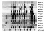Thumbnail of Restriction fragment length polymorphism patterns of 12 Beijing strains from Karonga District, Malawi. All strains were &gt;79% related to at least 1 of the other Beijing strains found in the district. Strain MT14323 is a reference strain.