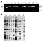 Thumbnail of Genotyping analysis of clinical isolates from patients with recurrent tuberculosis. Numbers represented the patients' codes. A) Gel electrophoresis analysis of the PCR products of the mycobacterial interspersed repetitive unit (MIRU) locus 10. bp, base pair; M: DNA marker; Rv, H37Rv positive control; ck, negative control. B) IS6110 restriction fragment length polymorphism analysis of some patients with different MIRU patterns.