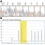 Thumbnail of DNA sequence electropherograms for neuraminidase (NA) gene sequences. A) Analysis of molecular markers (V116, I117, E119, Q136, K150, D151, D198, I223, H275, and N295) for oseltamivir and/or zanamivir resistance among the pandemic (H1N1) 2009 virus isolates. The oseltamivir resistance–conferring mutation CAC (histidine) to TAC (tyrosine) at position 275 was detected in the InDRE797 sample. B) Detection of the H275Y mutation in the NA of the viruses by single-nucleotide polymorphism