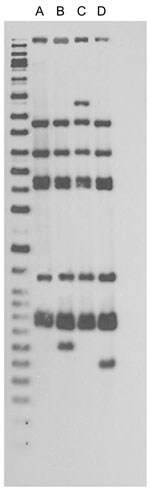 Thumbnail of IS6110 restriction fragment length polymorphism patterns for tuberculosis patients, New York, New York, USA, 2003–2009. Left lane, molecular mass ladder; lane A, n = 48; lane B, n = 1; lane C, n = 1; lane D, n = 4. Spoligotype results (octal code designation) were 777777774020771 for 54 patients. Twelve-loci mycobacterial interspersed repetitive-unit variable-number tandem repeat results were 225313153321 for 53 patients and 2253131–3321 for 1 patient; the dash indicates that there
