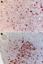 Thumbnail of Immunohistochemical analysis of brain of Natterer’s bat for lyssavirus antigen by using the avidin biotin complex method. A) Cerebrum showing a large number of neurons. Cytoplasmic granular-to-diffuse staining for rabies antigen is visible in the perikarya and neuronal processus. B) Medulla and neurons of the nucleus funiculi lateralis showing strong cytoplasmic staining for rabies antigen. Original magnifications ×20.