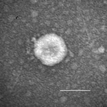 Thumbnail of Porcine deltacoronavirus (OH-FD22) particle detected in intestinal contents from a gnotobiotic pig. The sample was negatively stained with 3% phosphotungstic acid. Scale bar = 100 nm.