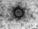 Thumbnail of Electron micrograph of a new chimeric swine enteric coronavirus (SeCoV/GER/L00930/2012), Germany, 2012. Scale bar indicates 100 nm.