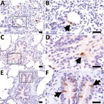Thumbnail of Influenza D virus immunohistochemistry in swine lung at 3 days (A and B), 5 days (C and D), and 7 days (E and F) postinoculation. Right column panels are higher magnification of boxed region in panels to the left. At all time points, scattered immunopositive bronchiolar epithelial cells were observed (arrows). Scale bars indicate 20 µm.