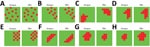 Thumbnail of Schematic representation of the spatial patterns of dengue and Zika risk revealed by the joint models of relative risk models, Colombia, 2015–2016. A) Model 1; B) model 2; C) model 3; D) model 4; E) model 5; F) model 6; G) model 7; H) model 8. For a set of small areas, high-risk areas are represented in red and low-risk areas are represented in green, depicting several patterns that could or could not be shared for both diseases in the same geographic area.
