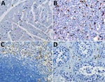 Thumbnail of Double immunohistochemical staining of Ebola virus (red) and CD163 antigen (brown) in tissues of patients who died of noninfectious causes. CD163 antigens in macrophages of heart (A), liver (Kupffer cells) (B), spleen (C), and testicle (D). Original magnification ×20.