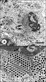 Thumbnail of Transmission electron micrographs of iridovirus cultured from the liver of a naturally diseased common frog (Rana temporaria) by using a fathead minnow epithelial cell line. 4a. Virus-infected cell. Large isocahedral viruses are conspicuous within the cytoplasm (arrows). Bar = 2 µm. 4b. Paracrystalline array of iridovirus. Bar = 200 µm.
