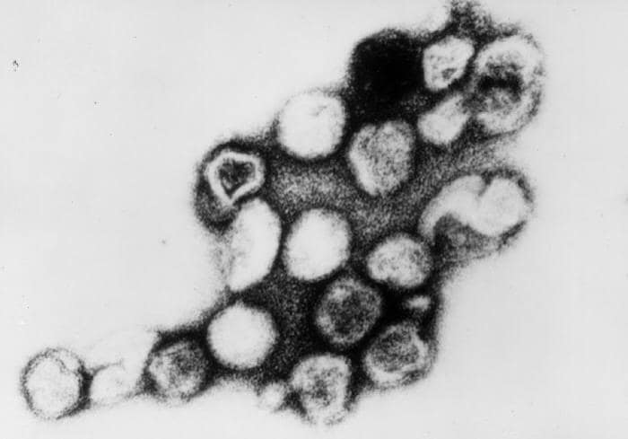This transmission electron microscopic (TEM) image depicts a number of rubella viral particles. Source: PHIL #269