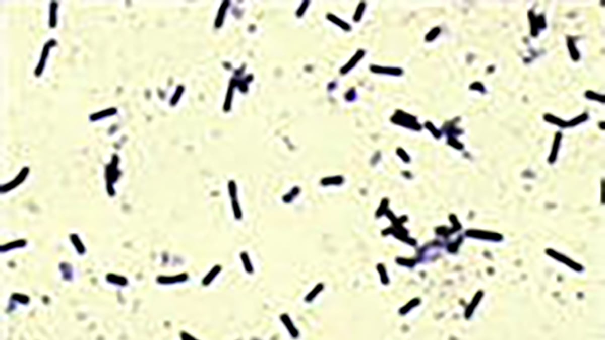 Medical illustration of Clostridium sordellii