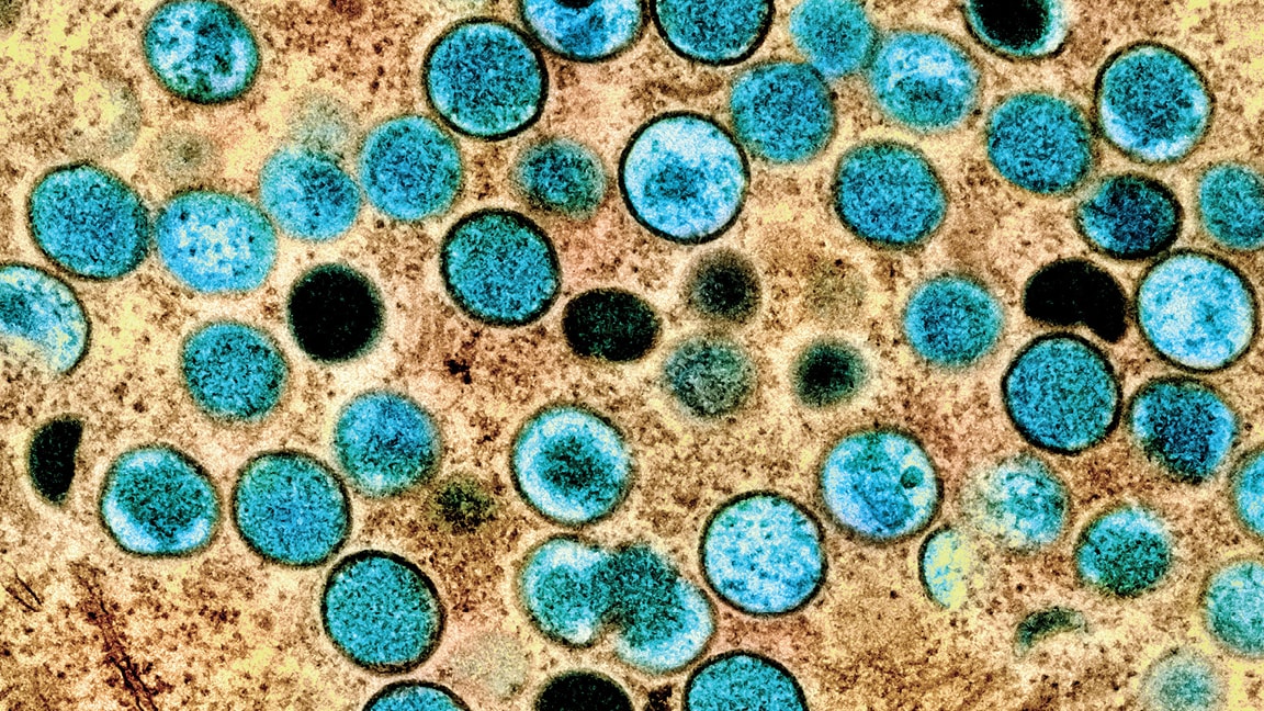 Microscopic image of mpox