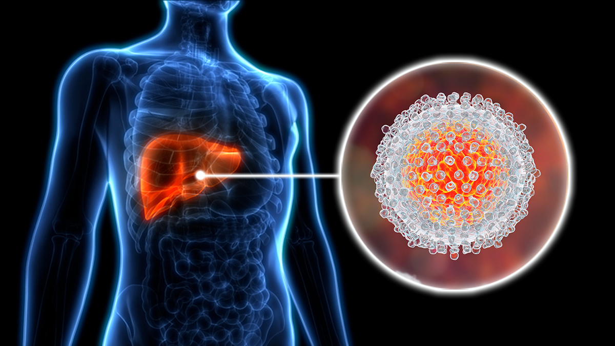 An illustration of the hepatitis c virus in the liver