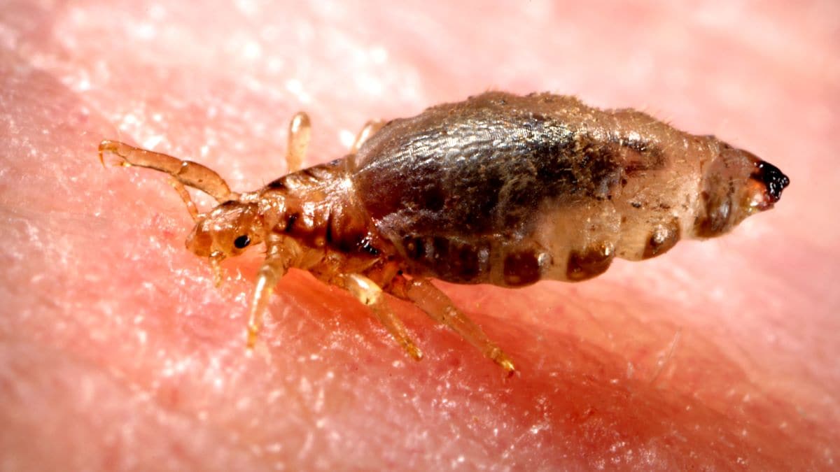 Image of a human body louse