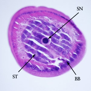 Figure F: Cross-section of the anterior end of the specimen in Figures D and E. Notice the bacillary band (BB), a stichocyte (ST) and stichosome nucleus (SN).
