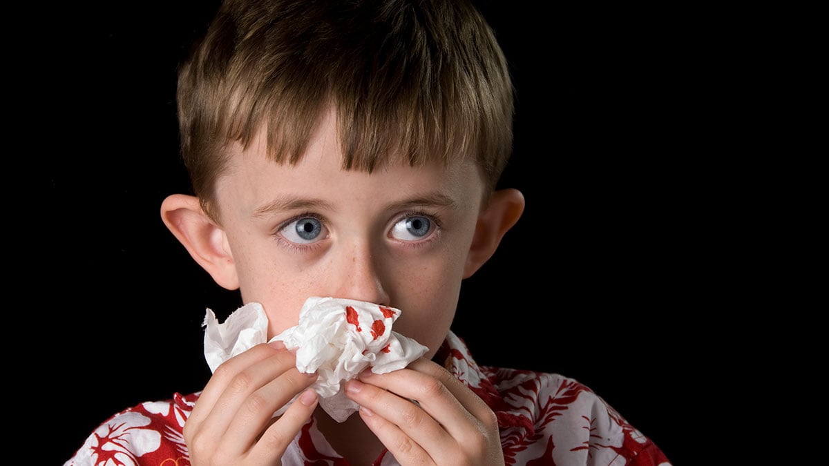 A young boy trying to stop a nose bleed with a tissue.