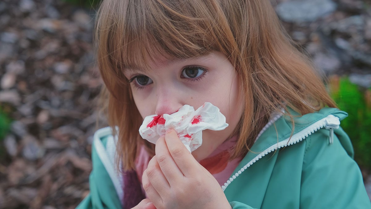 A young girl trying to stop a nosebleed with a paper tissue