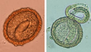 Left: Embryonated B. procyonis egg, showing the developing larva inside. Right: Larva of B. procyonis hatching from an egg.