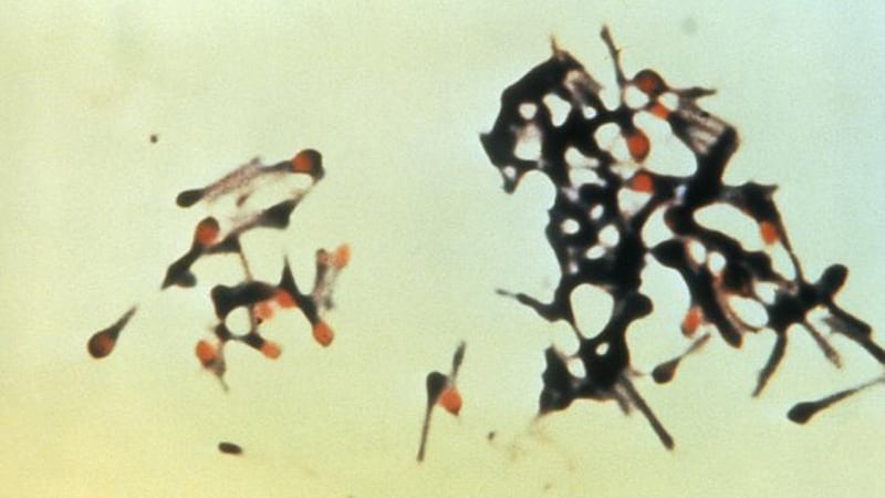 Clostridium tetani bacteria cause tetanus.