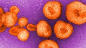 image of arenaviridae virus