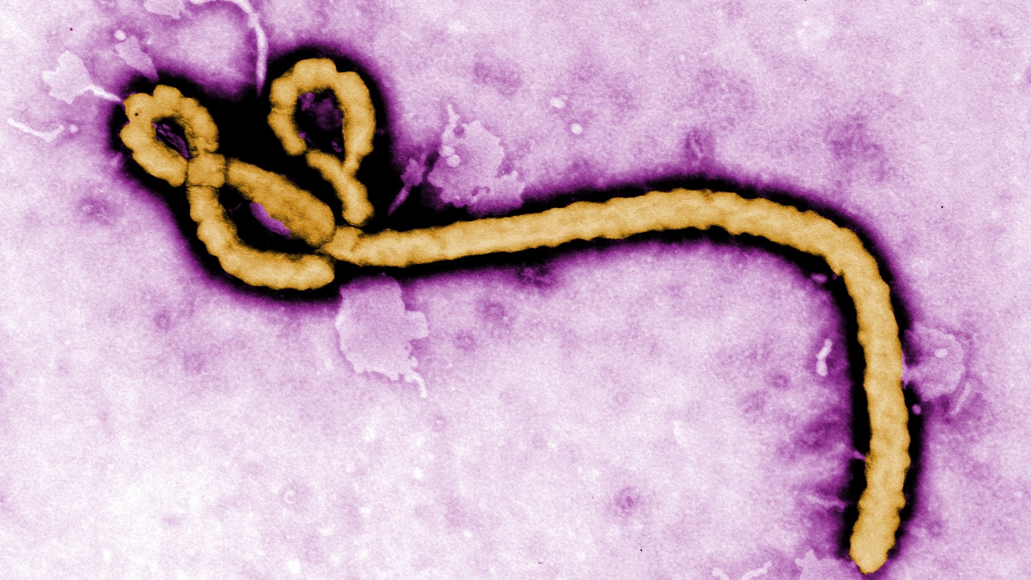 Microscopic image of the Ebola virus