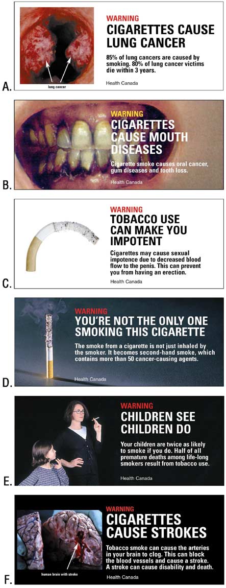 This is a series of six cigarette warning labels, A through F. Label A shows lungs with lung cancer and states, Warning: Cigarettes cause lung cancer. Label B displays an open mouth with dental problems and gum disease and the text, Warning: Cigarettes cause mouth diseases. Label C shows a curved, limp cigarette and the text, Warning: Tobacco use can make you impotent. Label D shows a burning cigarette standing on end with a caption about secondhand smoke that states, Warning: Youre not the only one smoking this cigarette. Label E shows a mother with a female child approximately aged 8 years with the text, Warning: Children see, children do. Label F displays a picture of a human brain following a stroke and the statement, Warning: Cigarettes cause strokes.