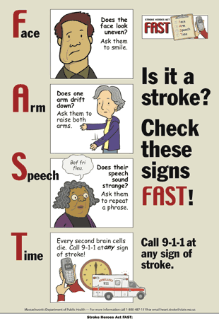This poster has four images to show how to identify stroke signs in someone and to encourage one to call 9-1-1 at any sign of stroke. The four images represent the acronym FAST. The first is F for face, and has a mans face that is uneven and droops on one side. The second is A for arm, and has a woman who seems unable to hold both arms up at the same time  one arm is lower than the other. The third is S for speech, and has a woman appearing to say something but the words are nonsense. The fourth is T for time, and has a phone, a clock, and an ambulance to stress the importance of calling 9-1-1 at any sign of stroke, because brain cells die every second during a stroke.