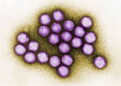 Colorized transmission electron micrograph of adenovirus.