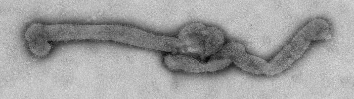 A Bourbon virus isolate under a microscope in a negative stain. The virus is long and in the photo is shown horizontally with a knot in the middle.