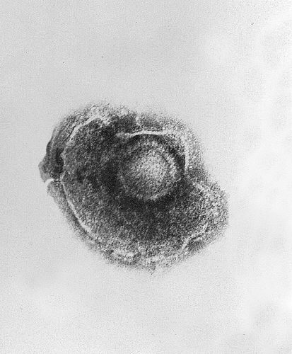 Electron micrograph of a varicella-zoster virus. Source: PHIL #1878.