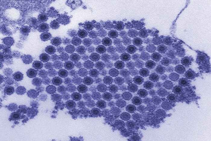 transmission electron micrograph (TEM) showing numerous Chikungunya virus particles