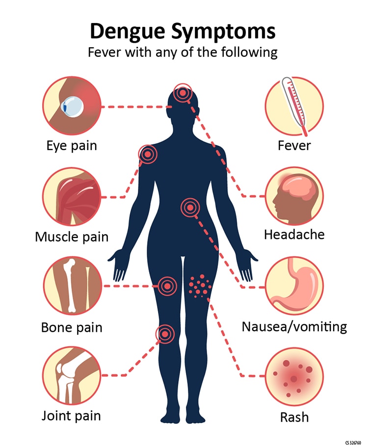 Graphic of human body showing most common symptom of dengue is fever with any of the following: eye pain, headache, muscle pain, rash, bone pain, nausea/vomiting, joint pain