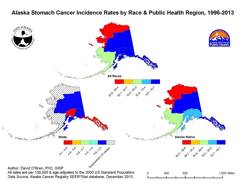 Stomach Cancer Incidence Rates by Race and Public Health Region, AK