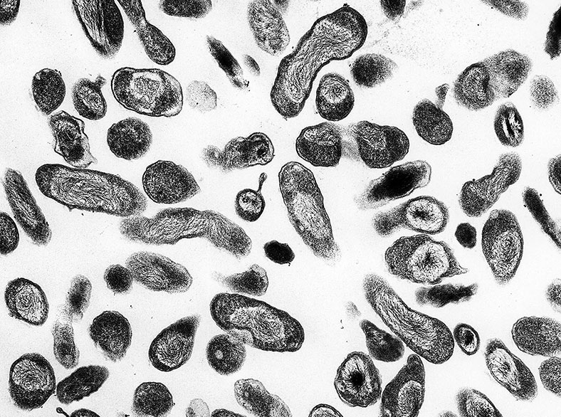 Image of a transmission electron micrograph which showed numerous <em>Coxiella burnetii</em> bacteria.