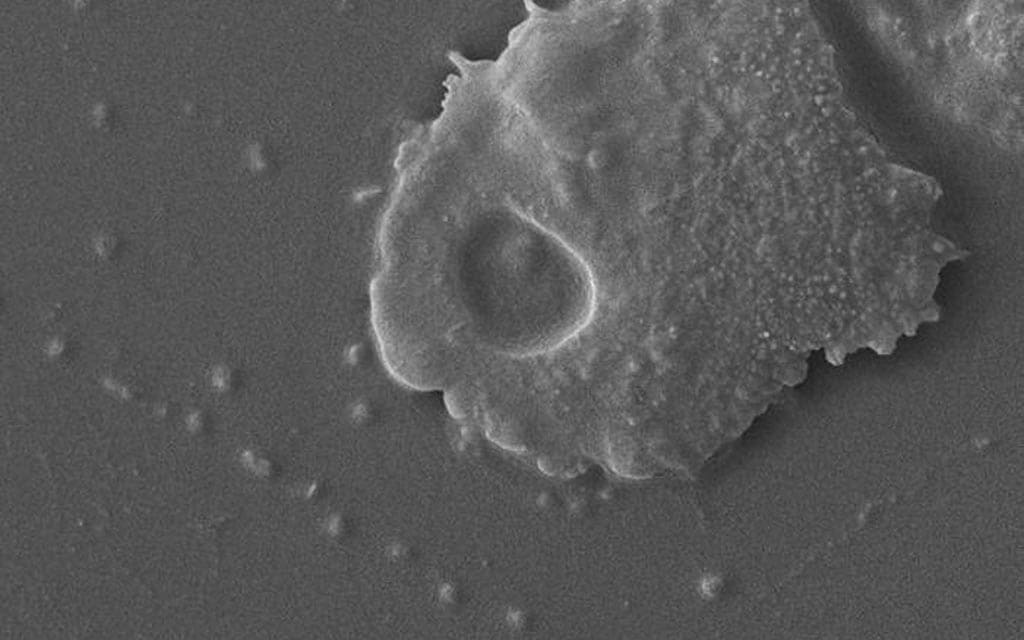 A scanning electron micrograph (SEM) of an <span class="italic">Acanthamoeba polyphaga</span> organism.