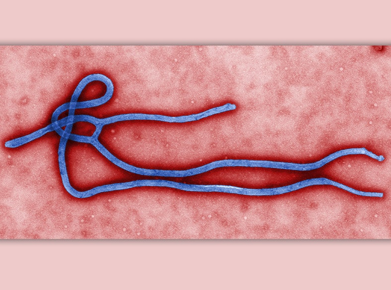 Ebola virus from an electron micrograph under high magnification.