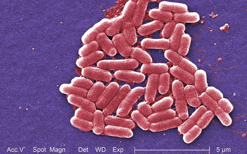 Digitally colorized image of <em>E. coli</em> O157:H7 under the high magnification of a scanning electron micrograph.