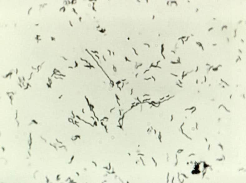 This digital image taken through a microscope shows a magnified view of <span class="italic">Campylobacter jejuni.</span>