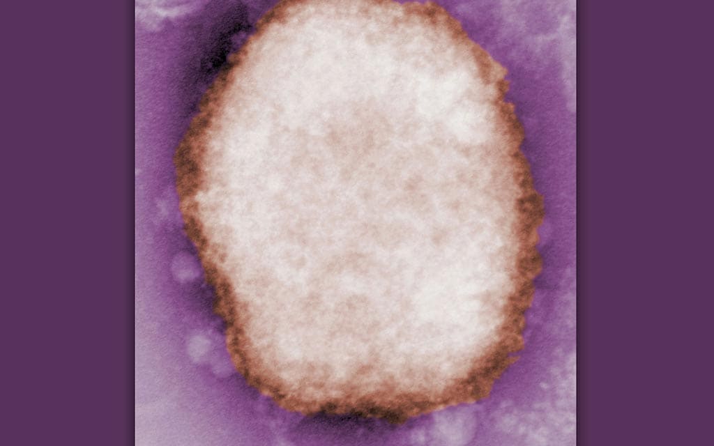 Transmission Electron Micrograph of monkeypox virus under high magnification.