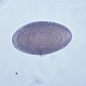Figure B: Egg of <em>M. hirudinaceous</em> in an unstained wet mount of stool.