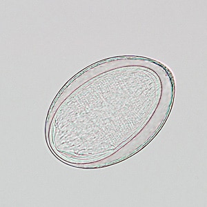 Figure B: Egg of <em>M. moniliformis</em> liberated from an adult worm that was recovered from the stool of a patient.