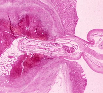 Figure D: Cross-section of the intestine of a pig, stained with H&E, showing the anterior end of an adult <em>Macracanthorhynchus hirudinaceous</em> embedded within the intestinal wall.