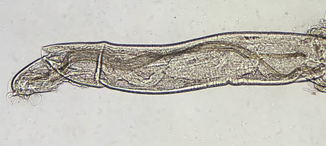 Figure C: Higher magnification of the worm in Figure B.