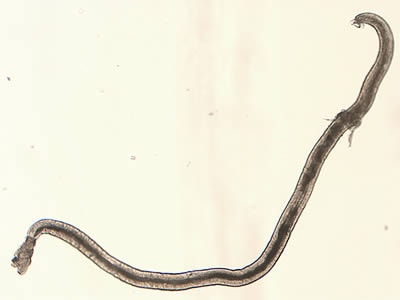 Figure A: <em>Angiostrongylus</em> sp. male worm, approximately 4.25 mm in length, recovered from vitreous humor of a human patient. The worm is most likely A. cantonensis based on the patient's geographic location.