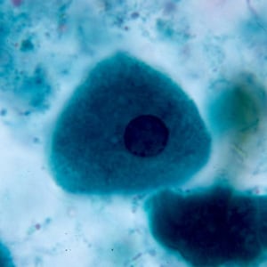 Figure C: Epithelial cell in a trichrome-stained stool smear.