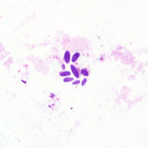 Figure A: Yeast in a Giemsa-stained tissue biopsy. Such objects may be confused for amastigotes of <em>Leishmania</em> or <em>Trypanosoma cruzi</em>, but the lack of a distinct nucleus and kinetoplast should rule-out these parasites.
