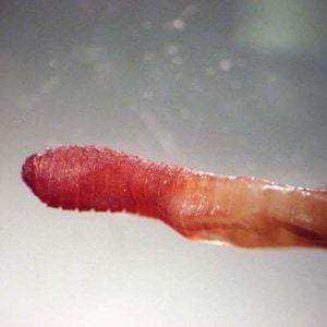 Figure A: Earthworms (<em>Lumbricus</em> and related) are commonly sent to the public health laboratories for identification. The presence of setae, segmentation, and a clitellum (red arrow, Figure B) should distinguish them from parasitic helminths. Images courtesy of the Kentucky Department of Health.