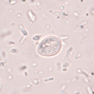 Figure C: Fungal spore in concentrated wet mounts of stool. Such spores may be confused for protozoa such as <em>Giardia</em> or <em>Chilomastix</em>.